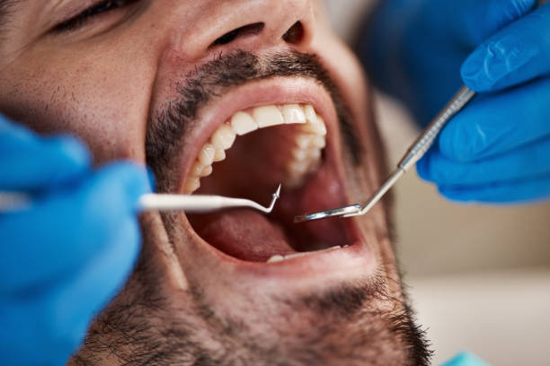 Best Emergency Broken Tooth Repair in Sells, AZ